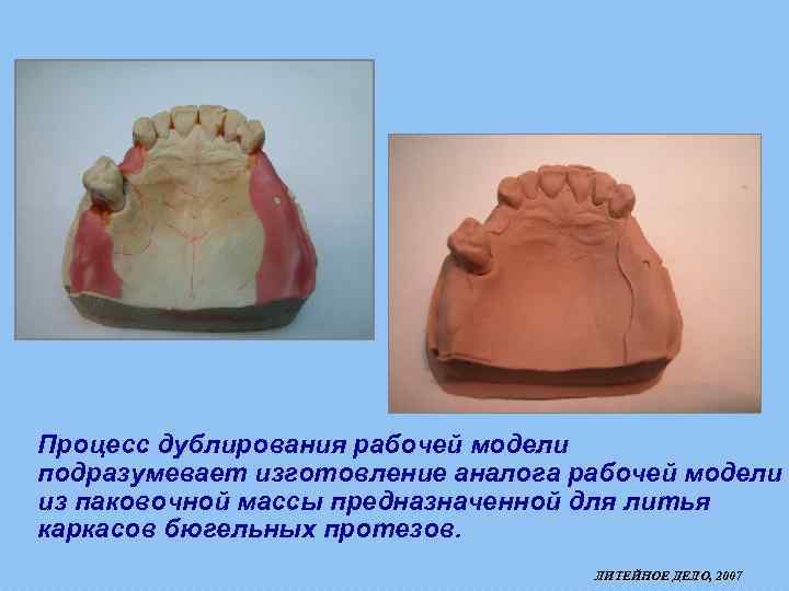 Процесс дублирования рабочей модели подразумевает изготовление аналога рабочей модели из паковочной массы предназначенной для