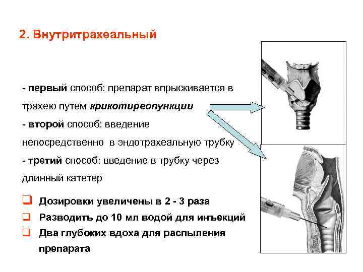 2. Внутритрахеальный - первый способ: препарат впрыскивается в трахею путем крикотиреопункции - второй способ: