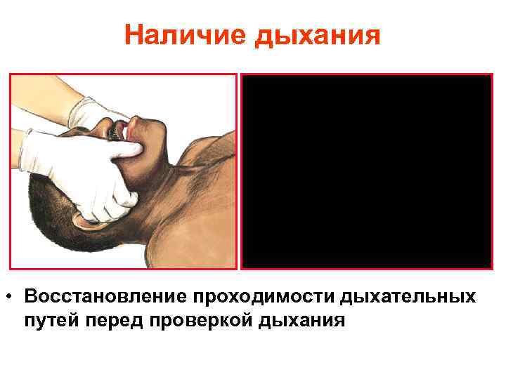 Наличие дыхания • Восстановление проходимости дыхательных путей перед проверкой дыхания 