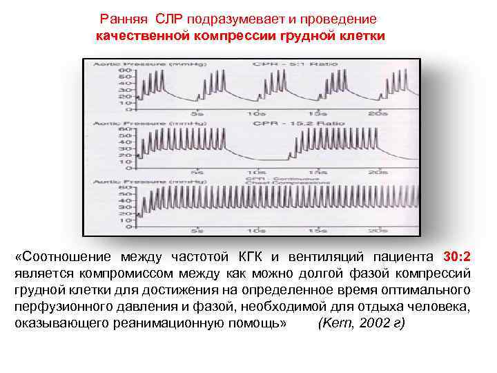 Ранняя СЛР подразумевает и проведение качественной компрессии грудной клетки «Соотношение между частотой КГК и