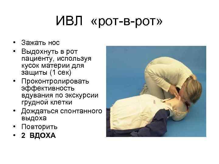 ИВЛ «рот-в-рот» • Зажать нос • Выдохнуть в рот пациенту, используя кусок материи для