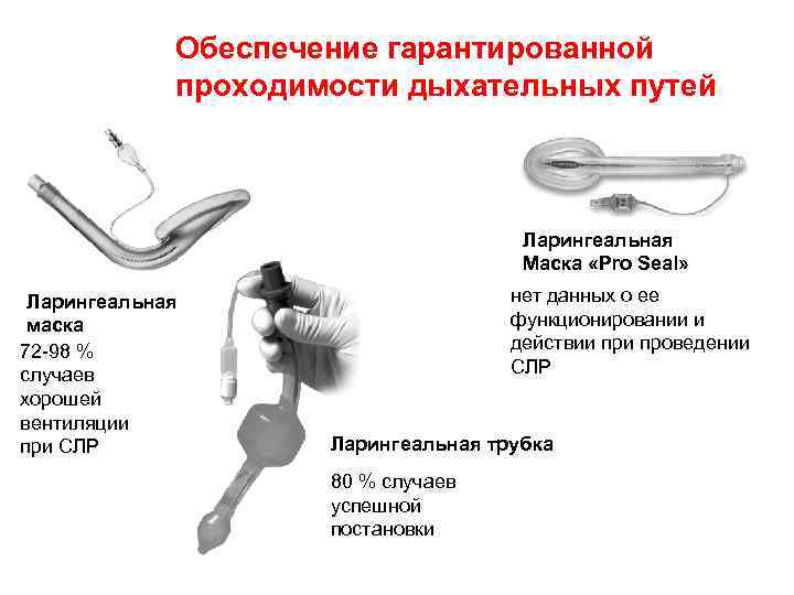Обеспечение гарантированной проходимости дыхательных путей Ларингеальная Маска «Pro Seal» Ларингеальная маска 72 -98 %