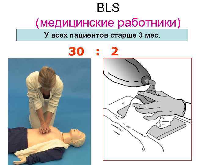 BLS (медицинские работники) У всех пациентов старше 3 мес. 30 : 2 