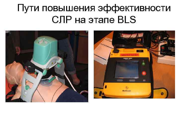 Пути повышения эффективности СЛР на этапе BLS 