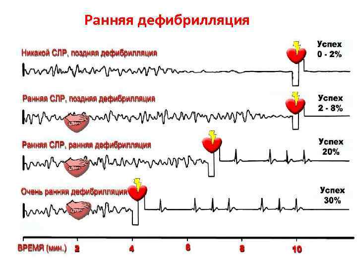 Ранняя дефибрилляция Lev Subbotin© ПЕРМСКАЯ Школа Медицины Катастроф 