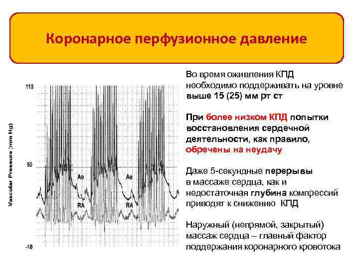 Коронарное перфузионное давление Во время оживления КПД необходимо поддерживать на уровне выше 15 (25)