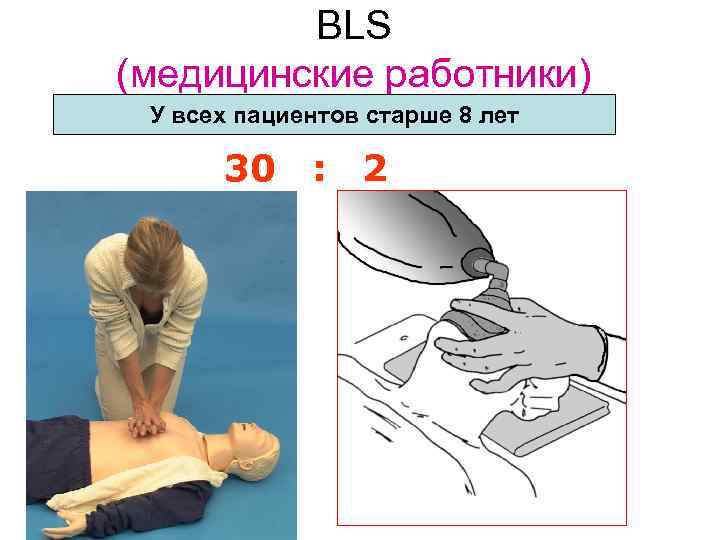 BLS (медицинские работники) У всех пациентов старше 8 лет 30 : 2 