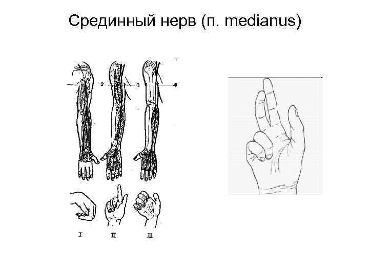 Срединный нерв (п. medianus) 