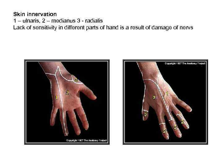 Skin innervation 1 – ulnaris, 2 – medianus 3 - radialis Lack of sensitivity