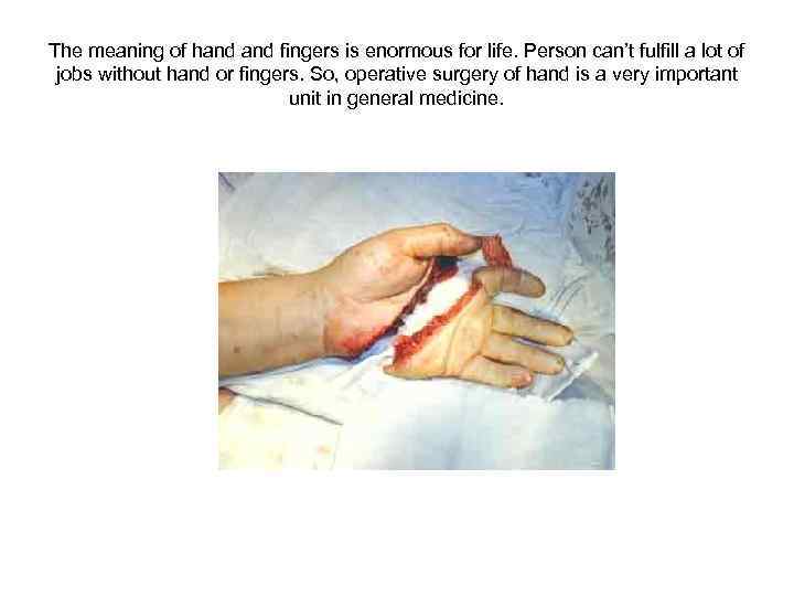 The meaning of hand fingers is enormous for life. Person can’t fulfill a lot