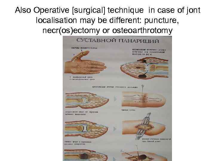 Also Operative [surgical] technique in case of jont localisation may be different: puncture, necr(os)ectomy