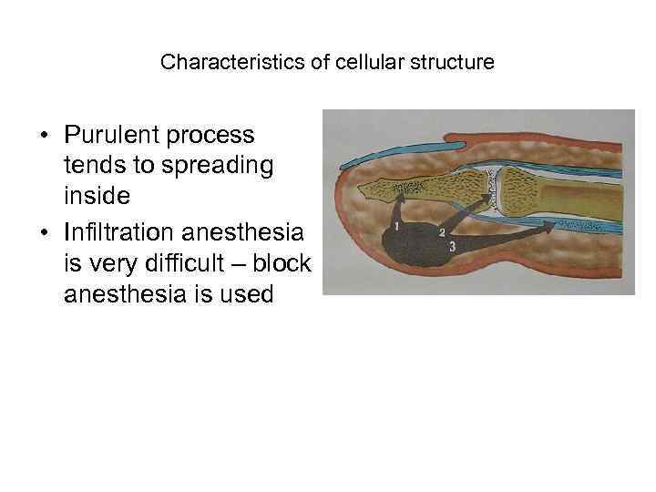 Characteristics of cellular structure • Purulent process tends to spreading inside • Infiltration anesthesia