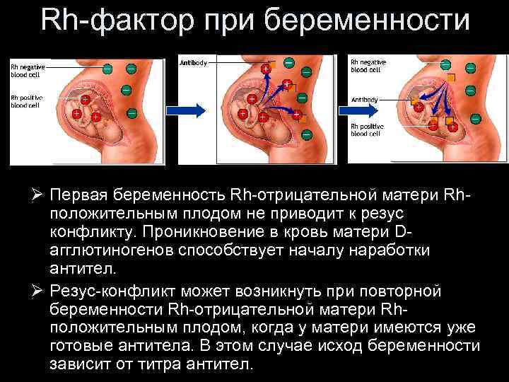 Rh-фактор при беременности Ø Первая беременность Rh-отрицательной матери Rhположительным плодом не приводит к резус