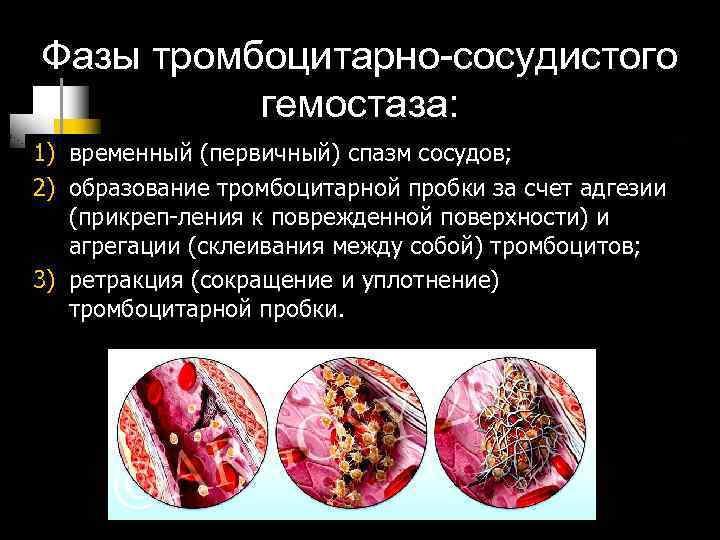 Фазы тромбоцитарно-сосудистого гемостаза: 1) временный (первичный) спазм сосудов; 2) образование тромбоцитарной пробки за счет