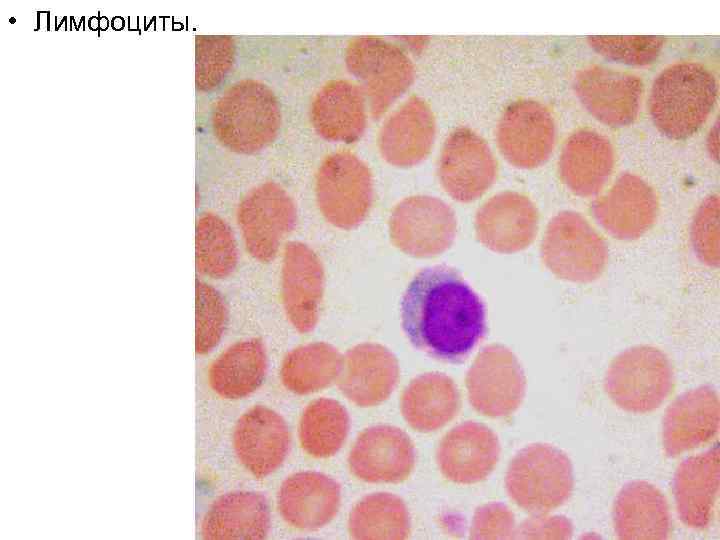  • Лимфоциты. 