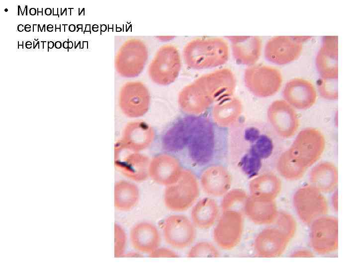  • Моноцит и сегментоядерный нейтрофил 