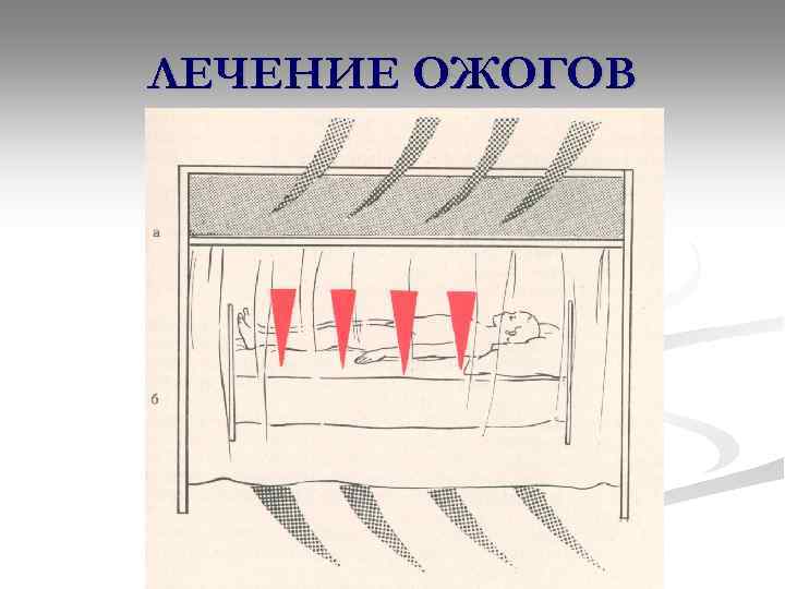 ЛЕЧЕНИЕ ОЖОГОВ 