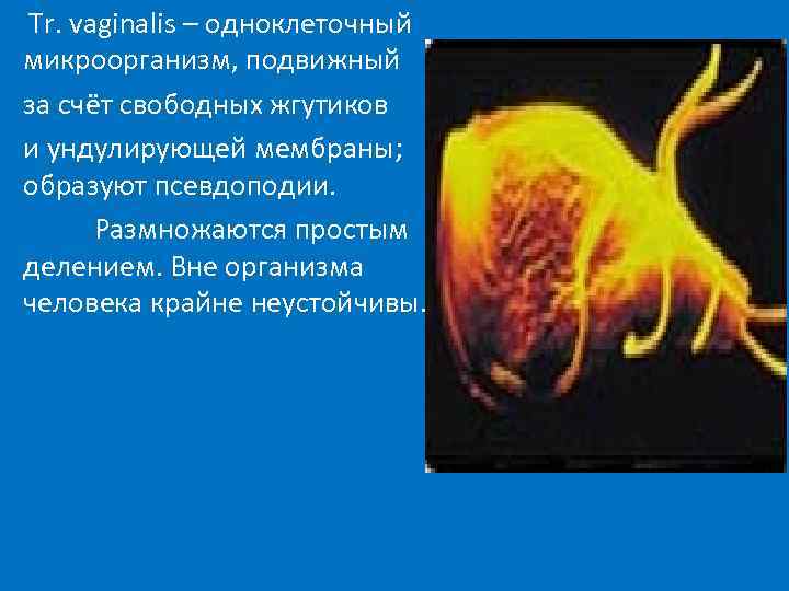  Tr. vaginalis – одноклеточный микроорганизм, подвижный за счёт свободных жгутиков и ундулирующей мембраны;