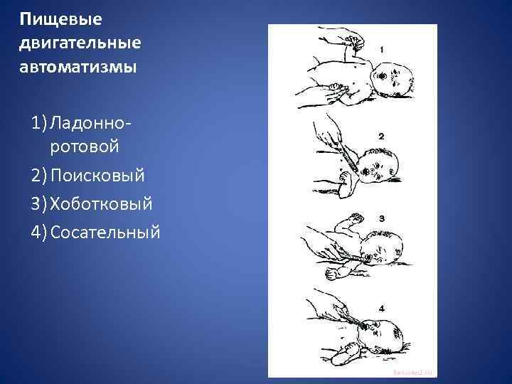 Пищевые двигательные автоматизмы 1) Ладонноротовой 2) Поисковый 3) Хоботковый 4) Сосательный 