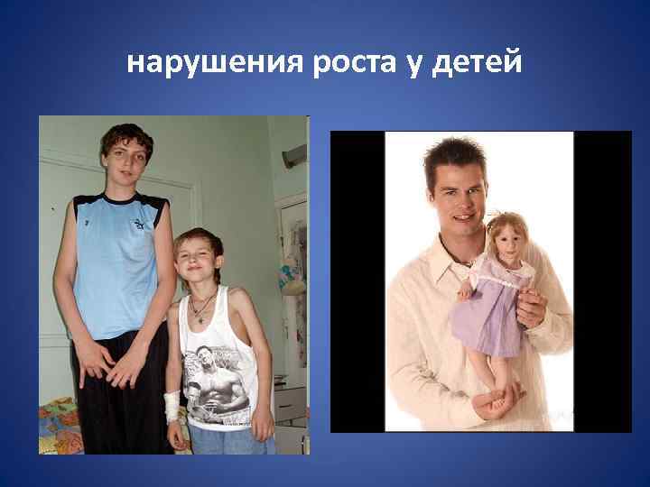 нарушения роста у детей 