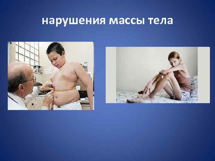 нарушения массы тела 
