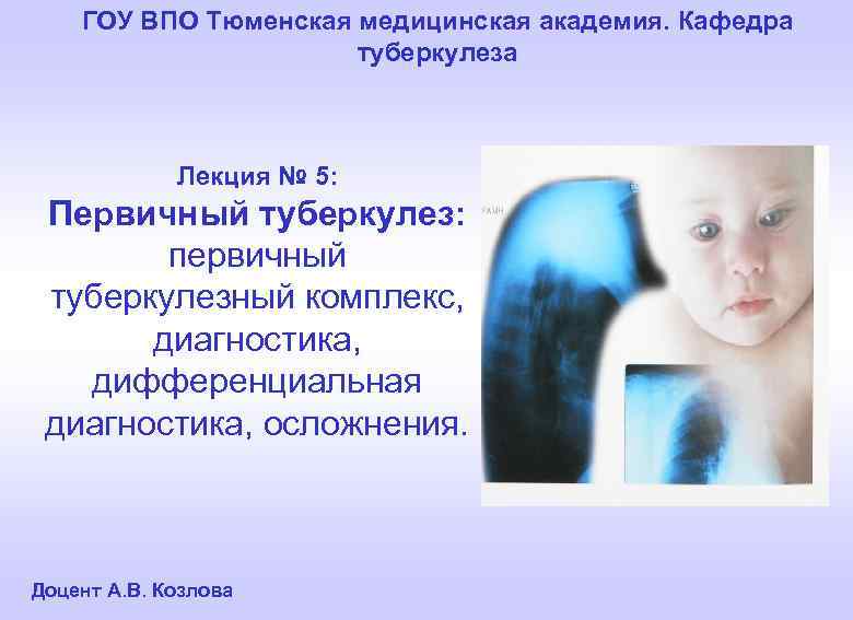 ГОУ ВПО Тюменская медицинская академия. Кафедра туберкулеза Лекция № 5: Первичный туберкулез: первичный туберкулезный