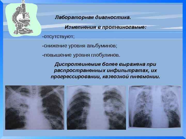 Лабораторная диагностика. Измепнения в протеиногамме: -отсутствуют; -снижение уровня альбуминов; -повышение уровня глобулинов. Диспротеинемия более