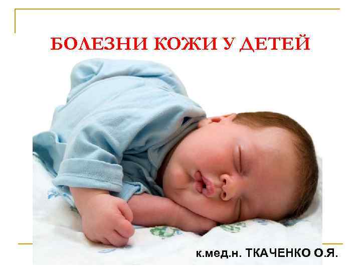 БОЛЕЗНИ КОЖИ У ДЕТЕЙ к. мед. н. ТКАЧЕНКО О. Я. 