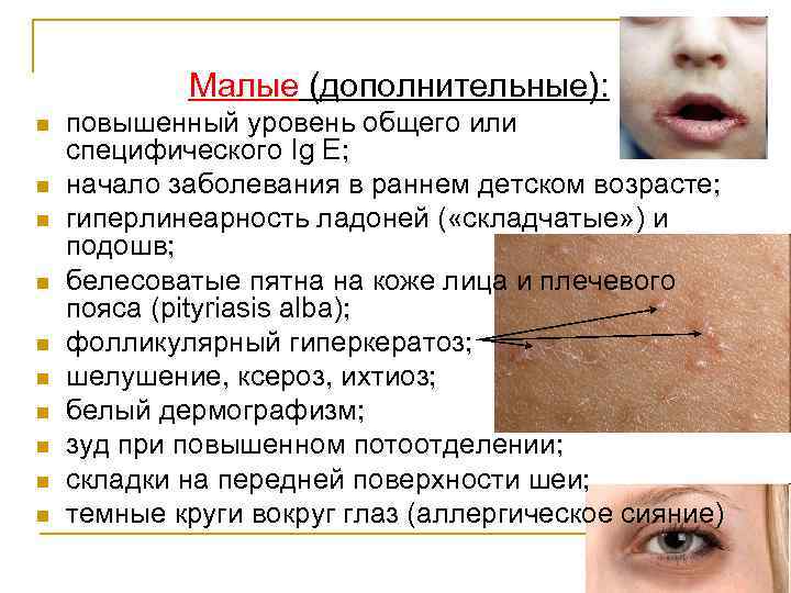 Семиотика поражения кожи у детей презентация