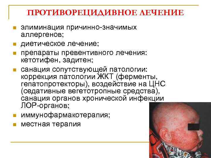 ПРОТИВОРЕЦИДИВНОЕ ЛЕЧЕНИЕ n n n элиминация причинно-значимых аллергенов; диетическое лечение; препараты превентивного лечения: кетотифен,