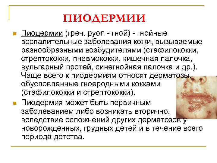 ПИОДЕРМИИ n n Пиодермии (греч. руоn - гной) - гнойные воспалительные заболевания кожи, вызываемые