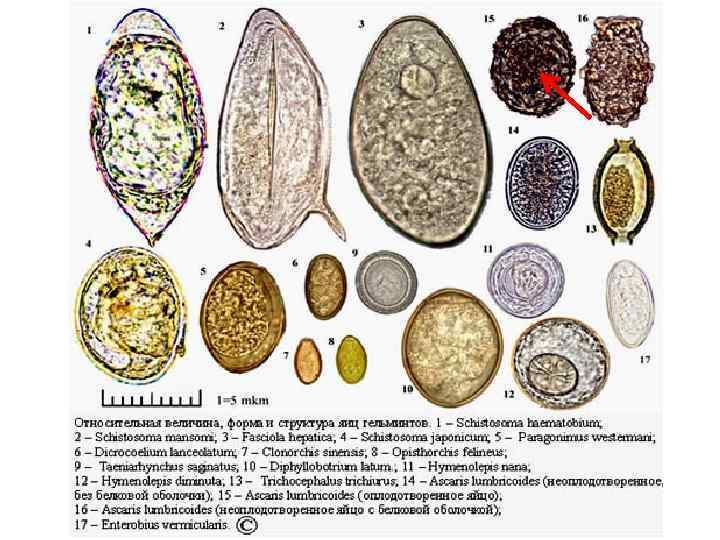 Лекция 20. Общая характеристика и классификация гельминтов