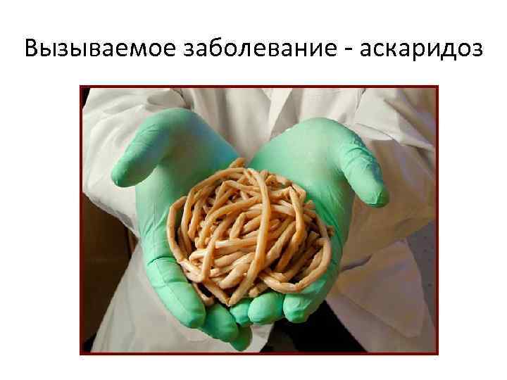 Вызываемое заболевание - аскаридоз 