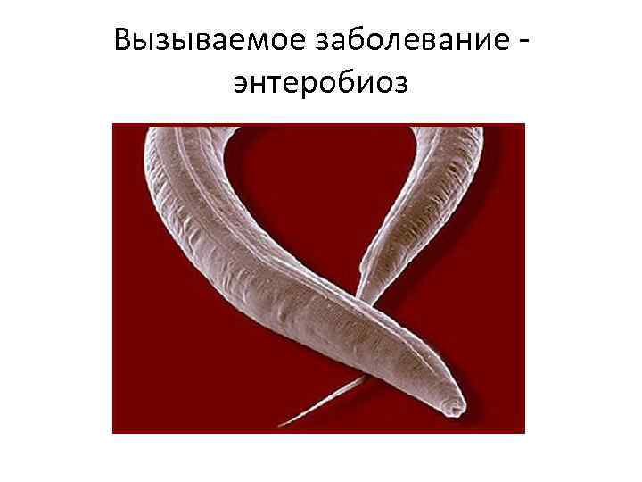 Вызываемое заболевание энтеробиоз 