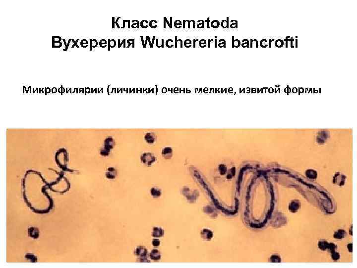 Класс Nematoda Вухерерия Wuchereria bancrofti Микрофилярии (личинки) очень мелкие, извитой формы 