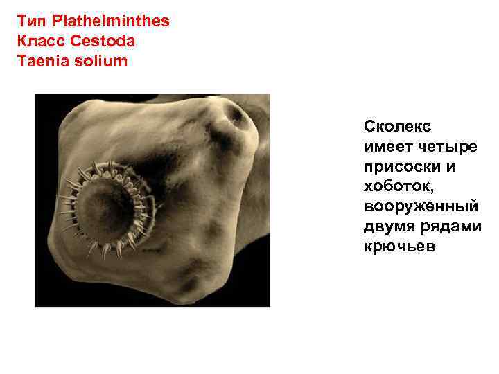 Тип Plathelminthes Класс Cestoda Taenia solium Сколекс имеет четыре присоски и хоботок, вооруженный двумя