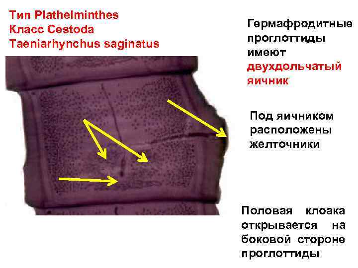 Тип Plathelminthes Класс Cestoda Taeniarhynchus saginatus Гермафродитные проглоттиды имеют двухдольчатый яичник Под яичником расположены