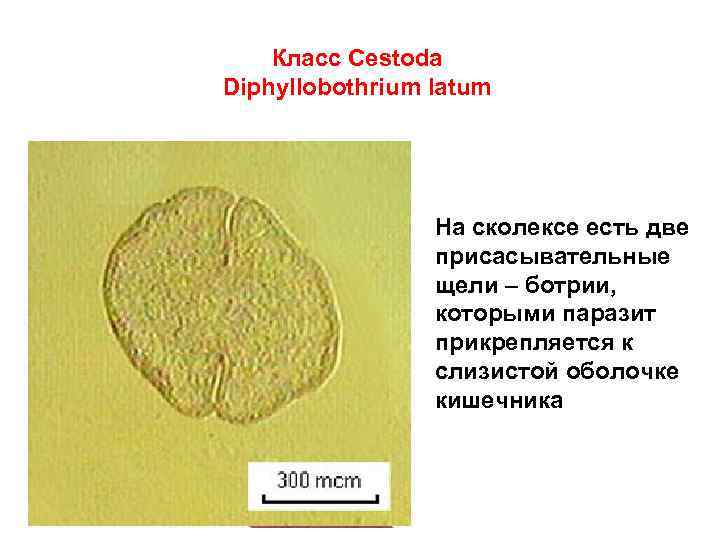 Класс Cestoda Diphyllobothrium latum На сколексе есть две присасывательные щели – ботрии, которыми паразит