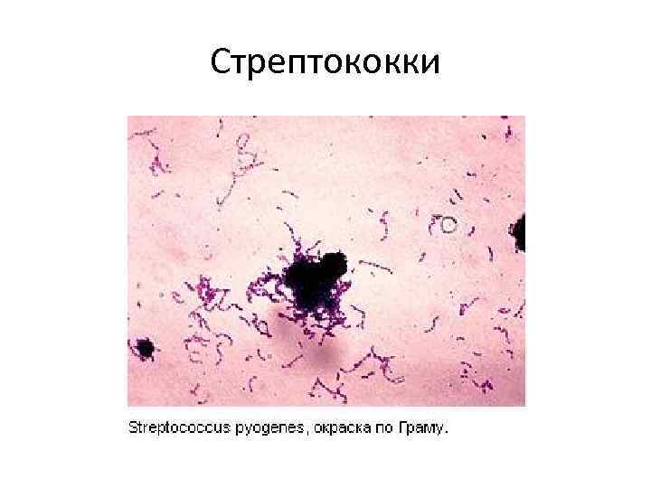 Стрептококки 