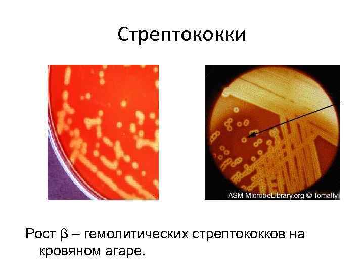 Стрептококки Рост β – гемолитических стрептококков на кровяном агаре. 