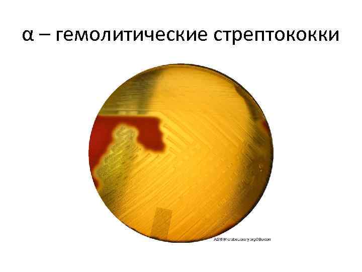 α – гемолитические стрептококки 