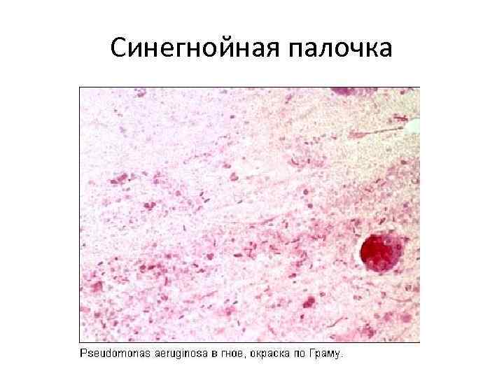 Синегнойная палочка 