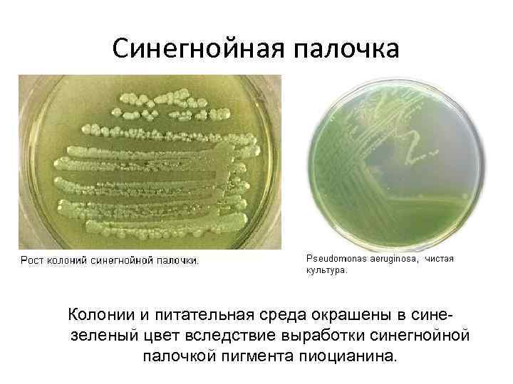 Синегнойная палочка Колонии и питательная среда окрашены в синезеленый цвет вследствие выработки синегнойной палочкой