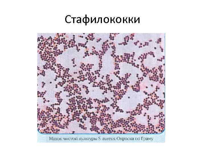 Staphylococcus aureus 10 3