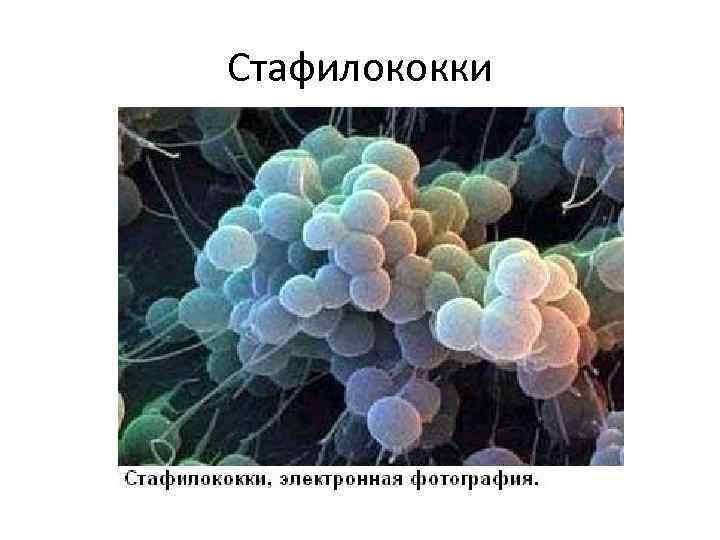 Стафилококки 