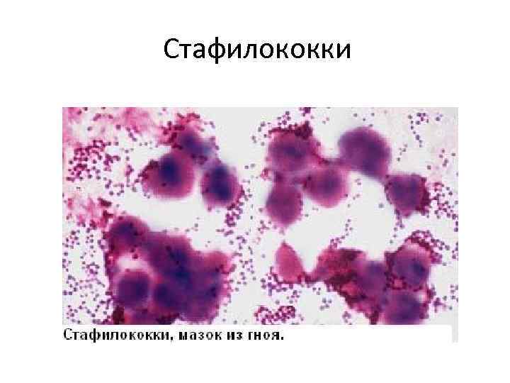 Стафилококки 