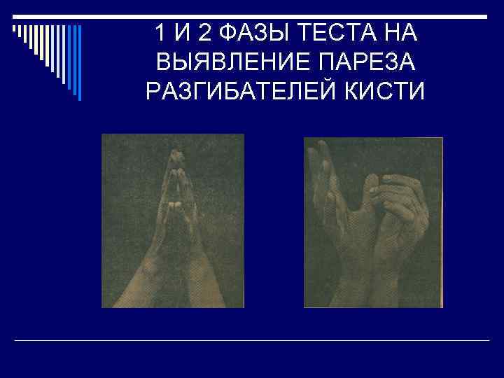 1 И 2 ФАЗЫ ТЕСТА НА ВЫЯВЛЕНИЕ ПАРЕЗА РАЗГИБАТЕЛЕЙ КИСТИ 