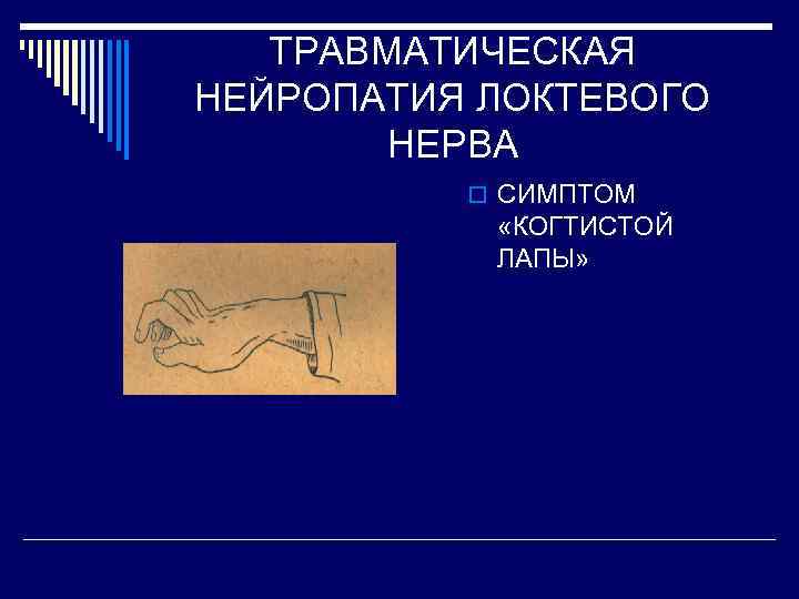 ТРАВМАТИЧЕСКАЯ НЕЙРОПАТИЯ ЛОКТЕВОГО НЕРВА o СИМПТОМ «КОГТИСТОЙ ЛАПЫ» 