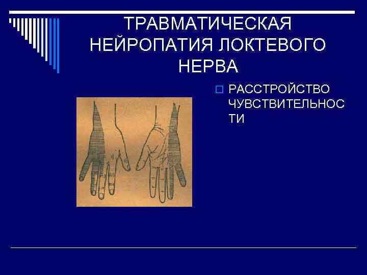 ТРАВМАТИЧЕСКАЯ НЕЙРОПАТИЯ ЛОКТЕВОГО НЕРВА o РАССТРОЙСТВО ЧУВСТВИТЕЛЬНОС ТИ 