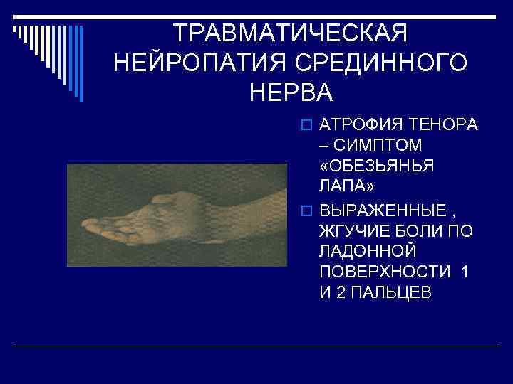 ТРАВМАТИЧЕСКАЯ НЕЙРОПАТИЯ СРЕДИННОГО НЕРВА o АТРОФИЯ ТЕНОРА – СИМПТОМ «ОБЕЗЬЯНЬЯ ЛАПА» o ВЫРАЖЕННЫЕ ,